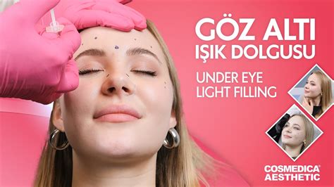 Cosmedica Aesthetic G Z Alt I K Dolgusu Under Eye Light Filling