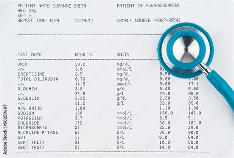 Blood test results in a clipboard with stethoscope Stock Photo | Adobe ...