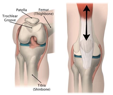 Patellofemoral Pain Syndrome (PFPS) - Motus Physical Therapy