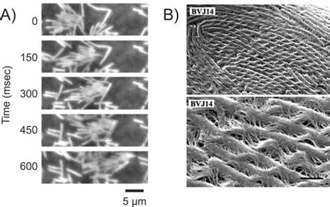 Swarming Motility in Proteus Mirabilis: Causative Agent of UTIs ...