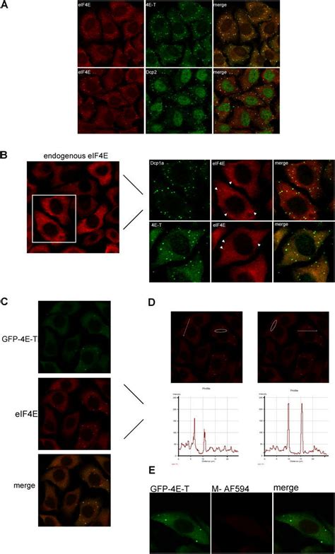 Eif4e Colocalizes With 4e T Dcp1a And Dcp2 In P Bodies A Hela