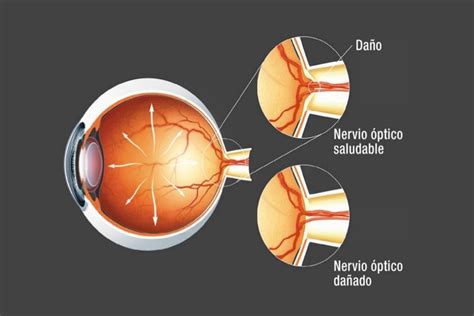 Sobrio Repetici N Todo El Tiempo Funcion Del Nervio Optico Del Ojo