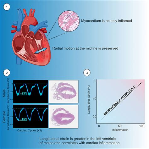 Sex Differences In Left Ventricular Strain In A Murine Model Of