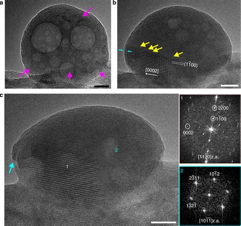 Transformation Of A Partially Crystallised ACP Particle A HRTEM Image