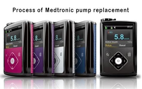 Medtronic Process For Faulty Insulin Pump Replacement Ipag Scotland