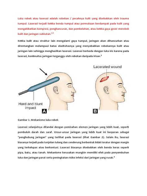 Mekanisme Luka Robek Pdf