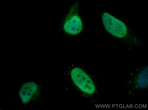 Histone H4 antibody (CL488-16047) | Proteintech