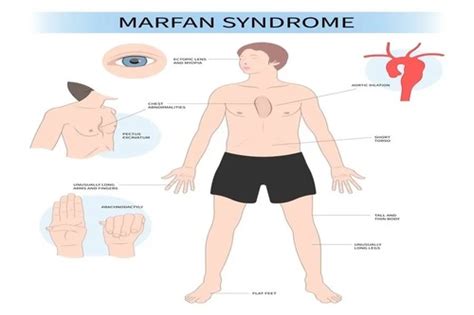 Usmle Step Flashcards Flashcards Quizlet