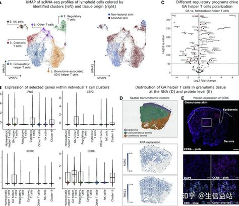 32分文章带你了解空间和单细胞转录组的强强联合 知乎