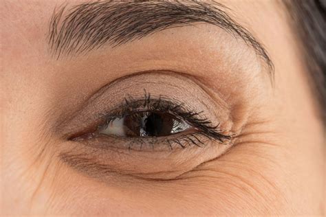 Tout savoir sur la blépharoplastie laser Multiesthetique fr