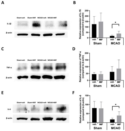 Ijms Free Full Text Neuroprotective Effect Of Macrophage Migration