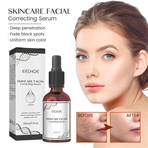 Retinol Dark Spot Remover Face Serum Whitening Skin Care Freckle