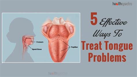 5 Effective Ways To Treat Tongue Problems Healthspectra Youtube