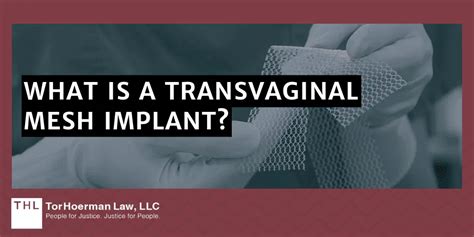 American Medical Systems Transvaginal Mesh Lawsuit [2024 Update]