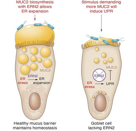 JCI Goblet Cells Need Some Stress