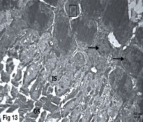 An Electron Micrograph Of Ultrathin Section Of Photoreceptors Of Group