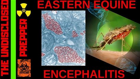 Eastern Equine Encephalitis Eee Virus Tripple E Virus Sleeping