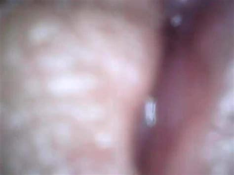 Endoscope Gay Man Porn XHamster