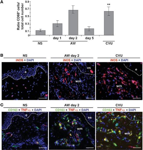 Table 1 From An Unrestrained Proinflammatory M1 Macrophage Population