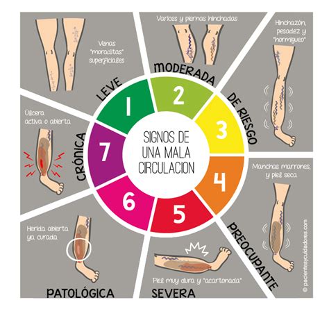 Signos De Una Mala Circulación Pacientes Y Cuidadorespacientes Y Cuidadores Información Y