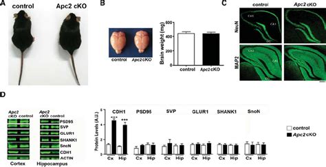 Normal Brain Morphology In Apc2 CKO Mice A Image Of An Apc2 CKO