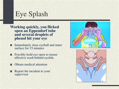 What Is Eye Spill At Seth Darcy Irvine Blog