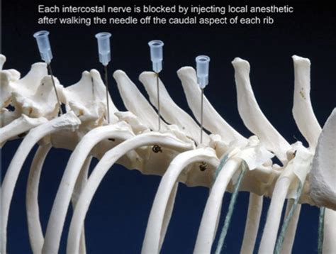 Anesthesia Final Exam Flashcards Quizlet