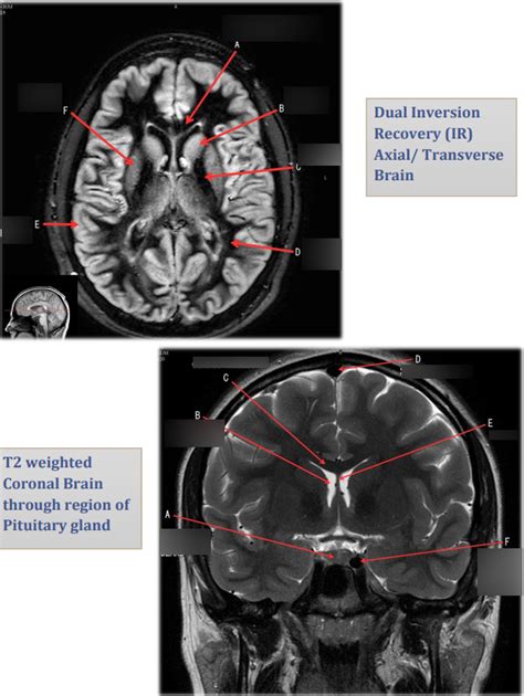 Brain 4 Diagram Quizlet