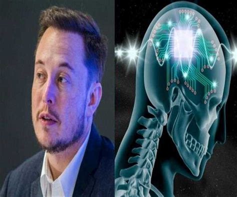 What does Elon Musk Neuralink is all about - MindStick YourViews