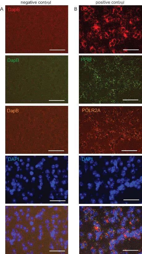 Combining Multiplex Fluorescence In Situ Hybridization With Fluorescent