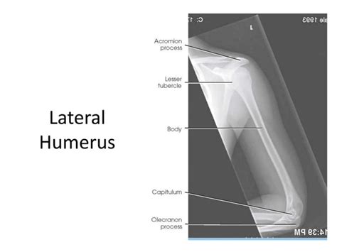 All Projections Anatomy Ppt