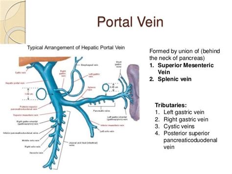 portacaval anastomosis