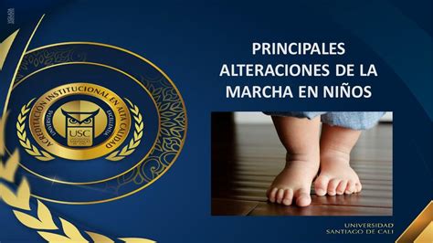 Principales Alteraciones de la Marcha en Niños Valeria Meji uDocz