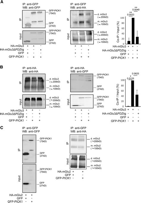 Modulation Of Hippocampal Network Oscillation By Pick Dependent Cell