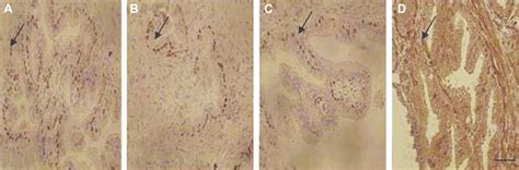 Photomicrograph Of Immunohistochemical Study On Rat Seminal Vesicles