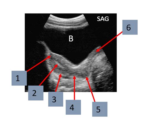 Flashcards Practical 2 Ultrasound Labs 11 17 Quizlet