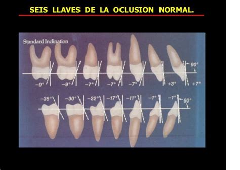 80518551 Seis Llaves De La Oclusion Normal 1 2015