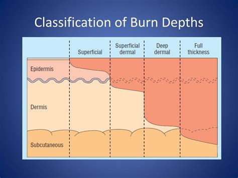 Classification Of Burns Concept Map