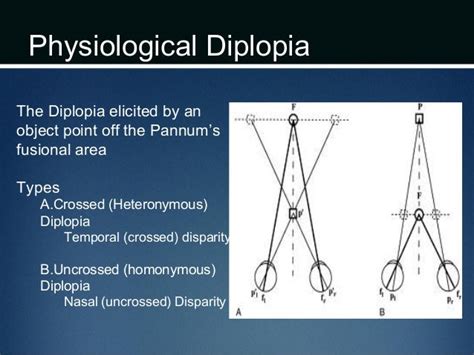 Basics Of Binocular Vision