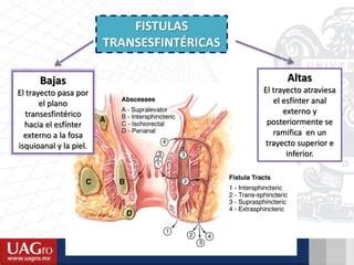 Fisura Absceso Y Fistula Anal Ppt