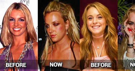 Before And After Drugs Photos Of Celebrities