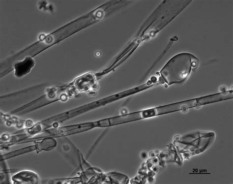 Mucor racemosus - Culture, Infection, Causes and Treatment