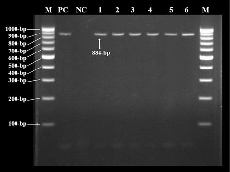 Pcr For The Detection Of E Coli Pcr For The Detection Of E Coli