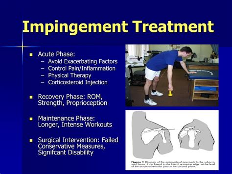 Shoulder Impingement Syndrome