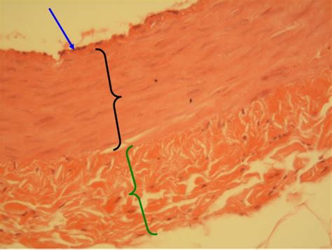 Blood Vessel Histology 1 Diagram Quizlet