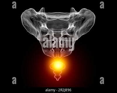 Coccyx Pain Conceptual Illustration Stock Photo Alamy