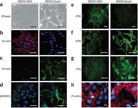 Immunophenotypical Characterization Of Emt In Two Dimensional