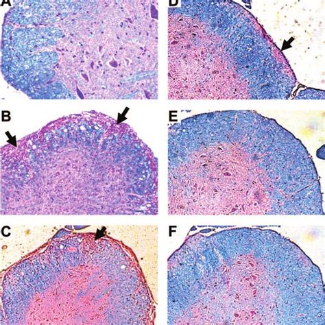 Histological Analysis Of Spinal Cord Sections Of Mice Suffering From Download Scientific