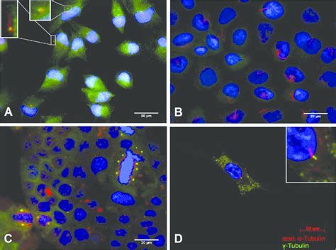 Pc In Pancreatic Stellate Cells Psc And Pancreatic Cancer Cell Lines