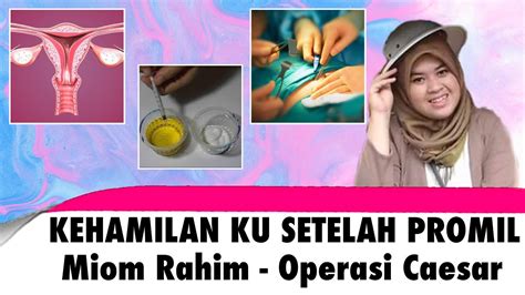 PENGALAMAN SETELAH PROGRAM HAMIL Kehamilan Miom Rahim Dan Operasi